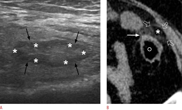 Fig. 12.