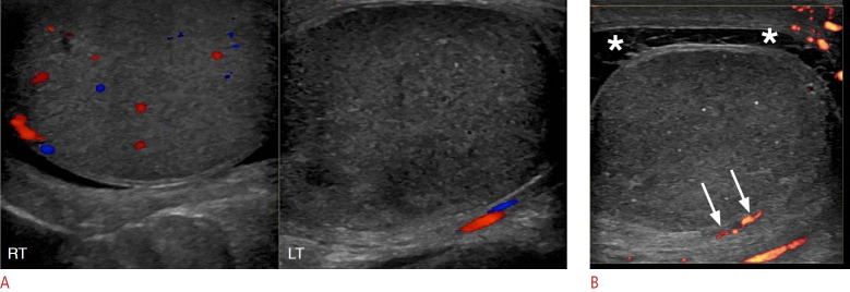 Fig. 13.