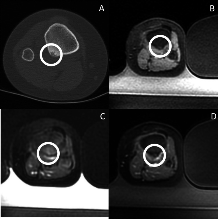 Fig. 2