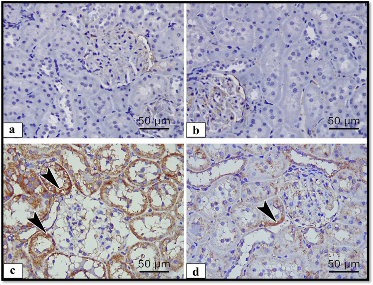 Hesperidin Protects Against Aluminum-induced Renal Injury In Rats Via 