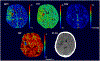Fig. 4
