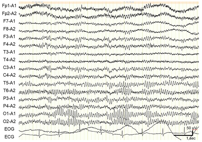 Figure 2.