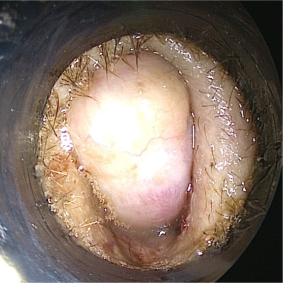 Fig. 1