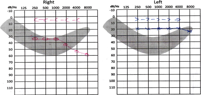 Fig. 2