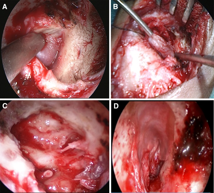 Fig. 4
