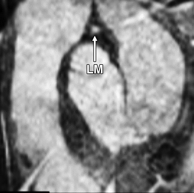 Figure 2c: