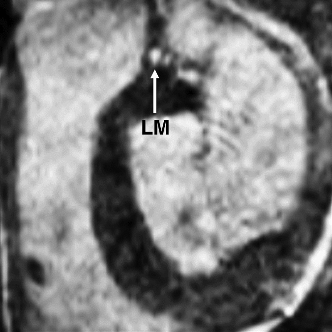 Figure 2d: