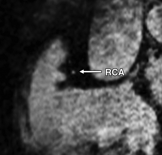 Figure 1c: