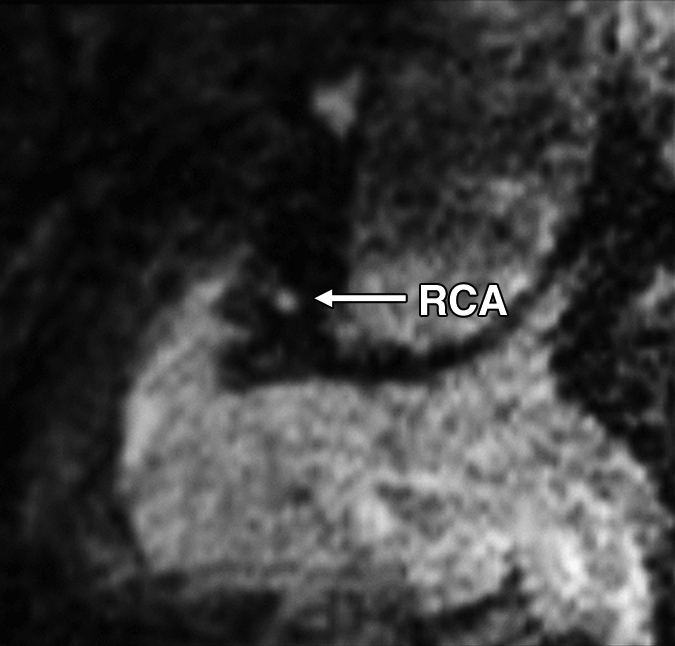 Figure 1d: