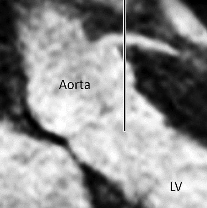 Figure 2b: