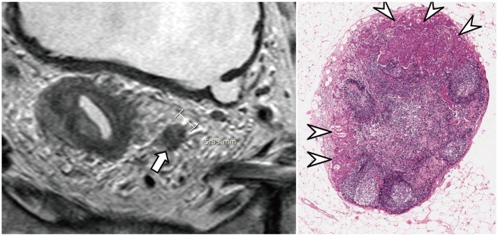 Fig. 13