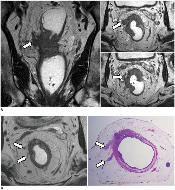 Fig. 14