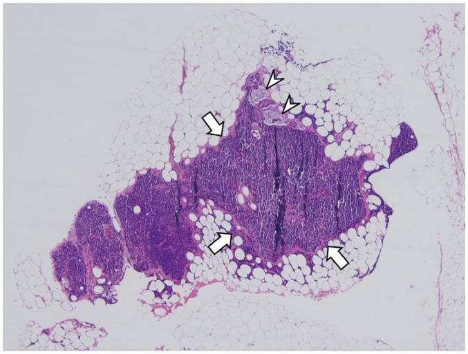 Fig. 11