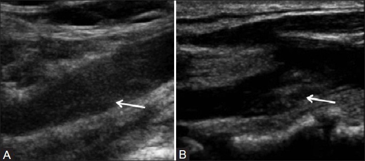 Figure 1 (A, B)