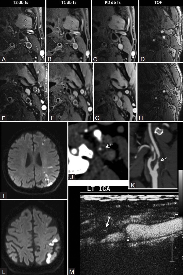 Figure 6 (A-M)