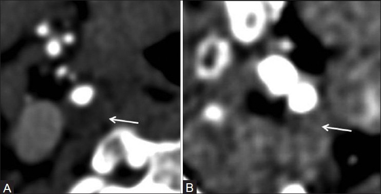 Figure 10 (A, B)