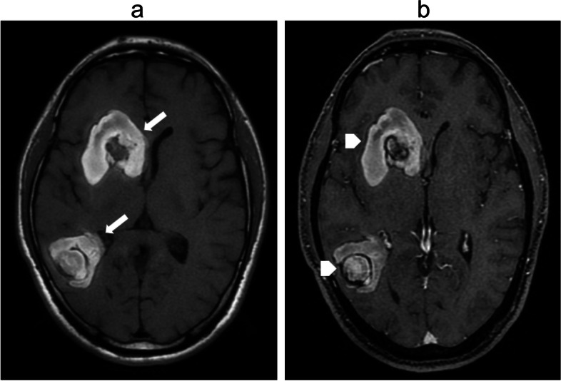 Fig. 9