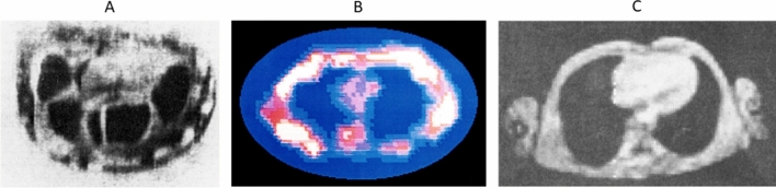 Fig. 1