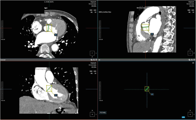 Fig. 2