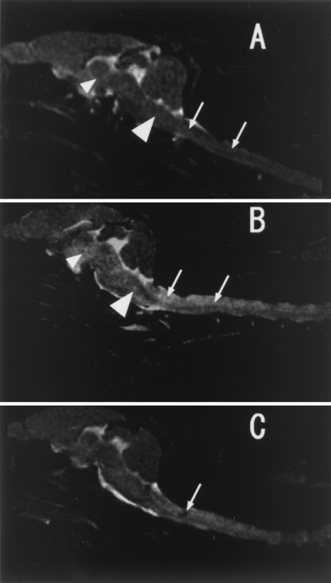 FIG. 3