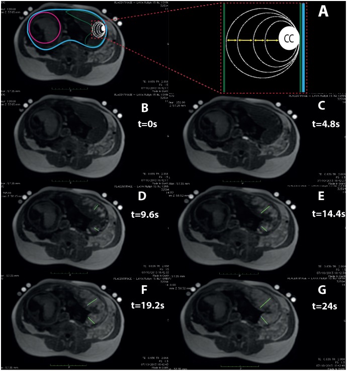 Fig 6