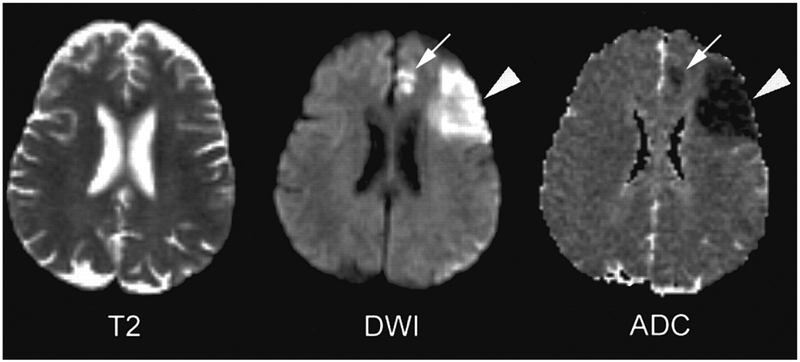 Figure 12.5