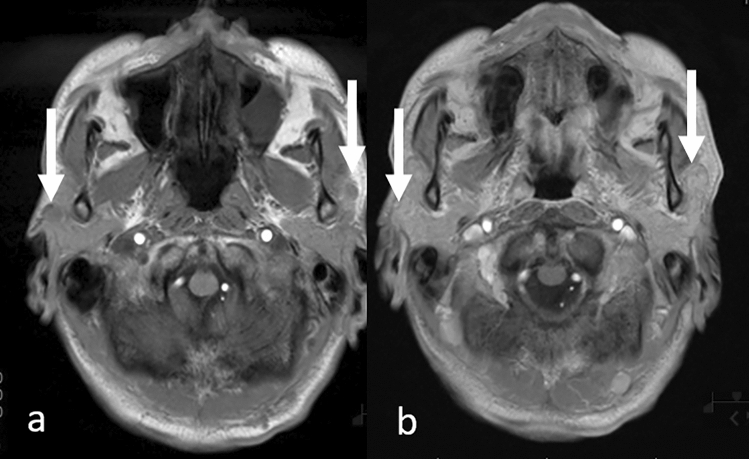 Fig. 16