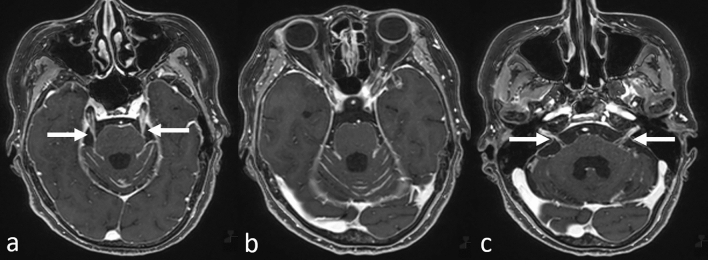 Fig. 5