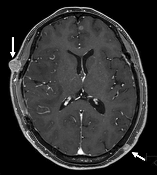 Fig. 15