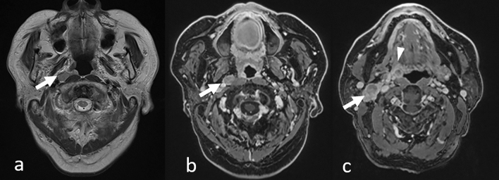 Fig. 19