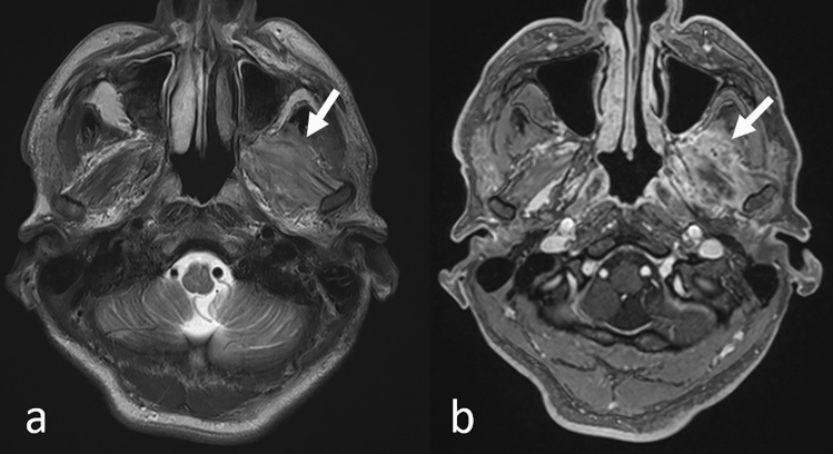 Fig. 12