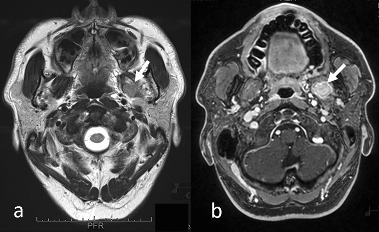 Fig. 11