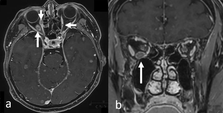 Fig. 13