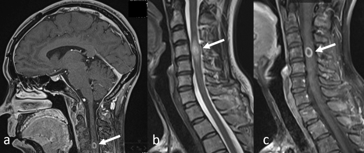 Fig. 17