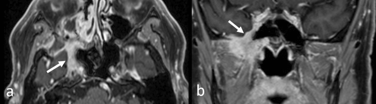 Fig. 18