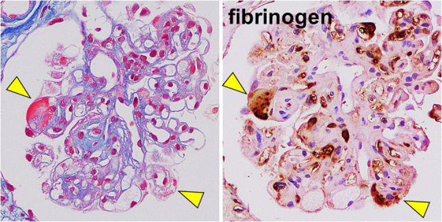 Fig. 8