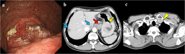 Fig. 1