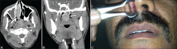 Figure 3(A-C):