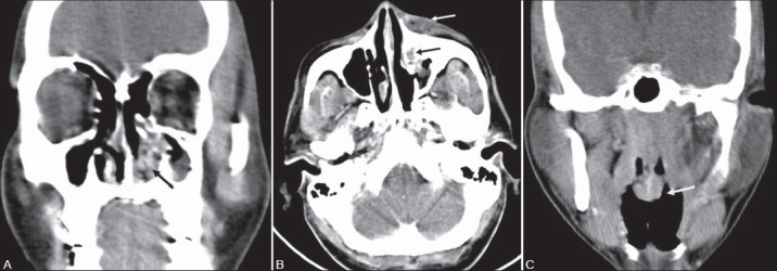 Figure 2(A-C):