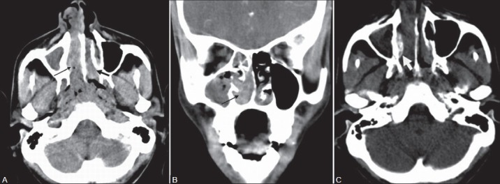 Figure 1(A-C):