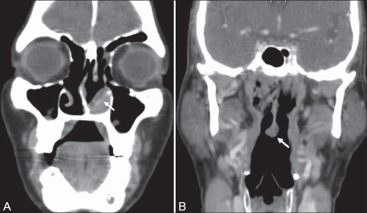 Figure 5(A, B):