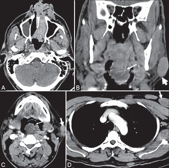 Figure 6(A-D):