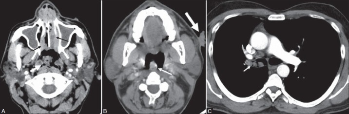 Figure 4(A-C):