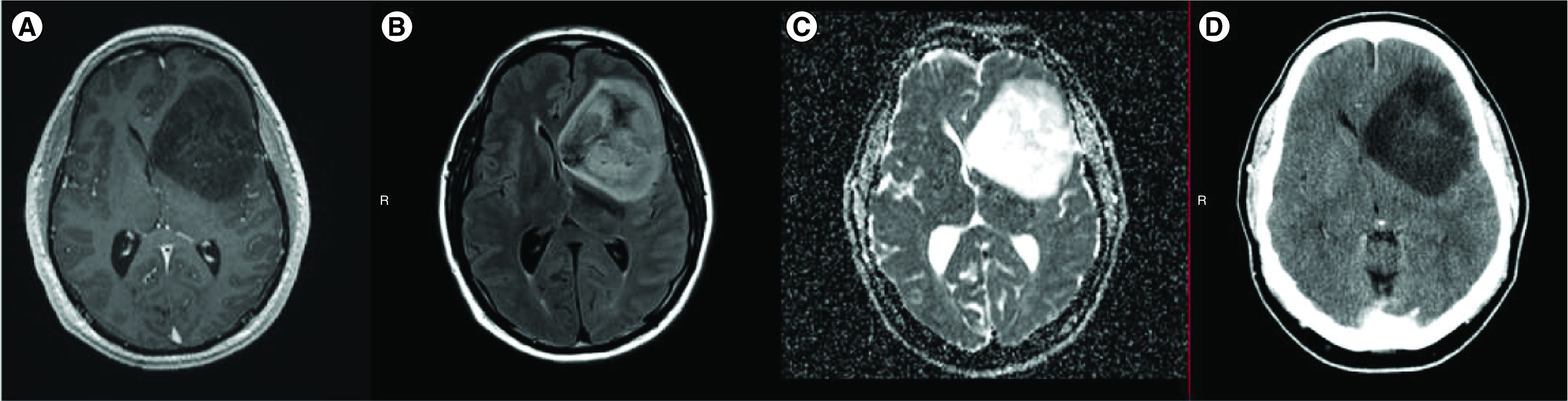 Figure 2. 