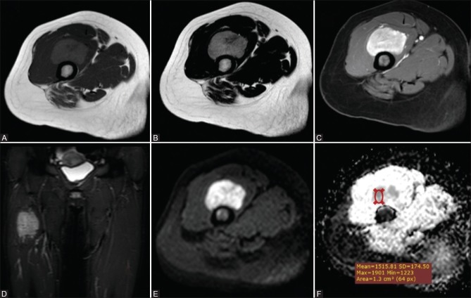 Figure 2 (A-F)