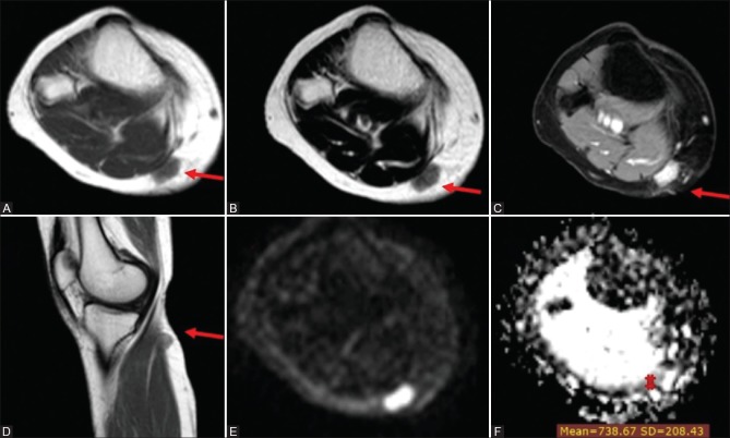 Figure 3 (A-F)