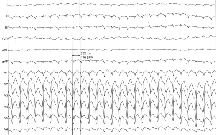 Figure 3