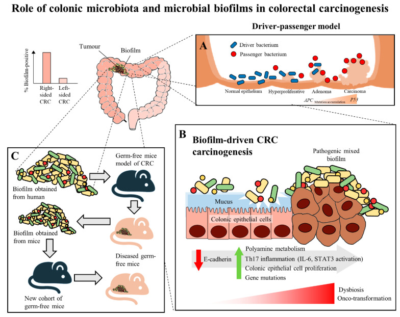 Targeting Gut Microbial Biofilms—A Key to Hinder Colon Carcinogenesis ...