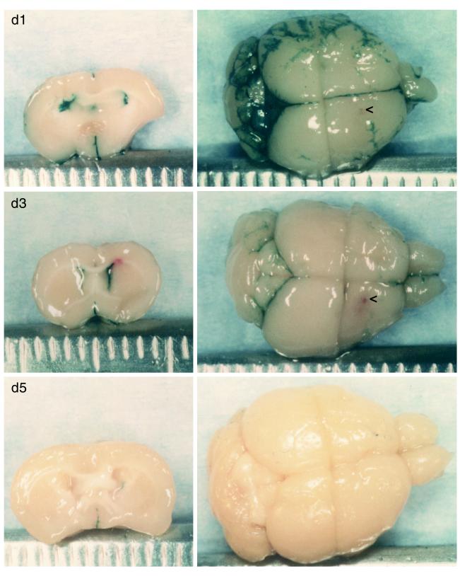 FIG. 1