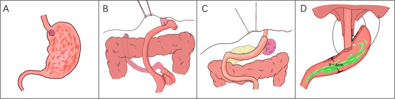 Fig. 1